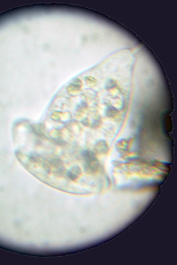 Due ciliati: Vorticella e .....